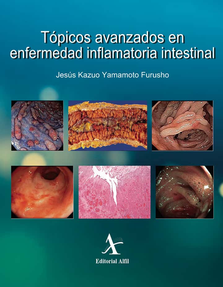 Tópicos avanzados en enfermedad inflamatoria intestinal
