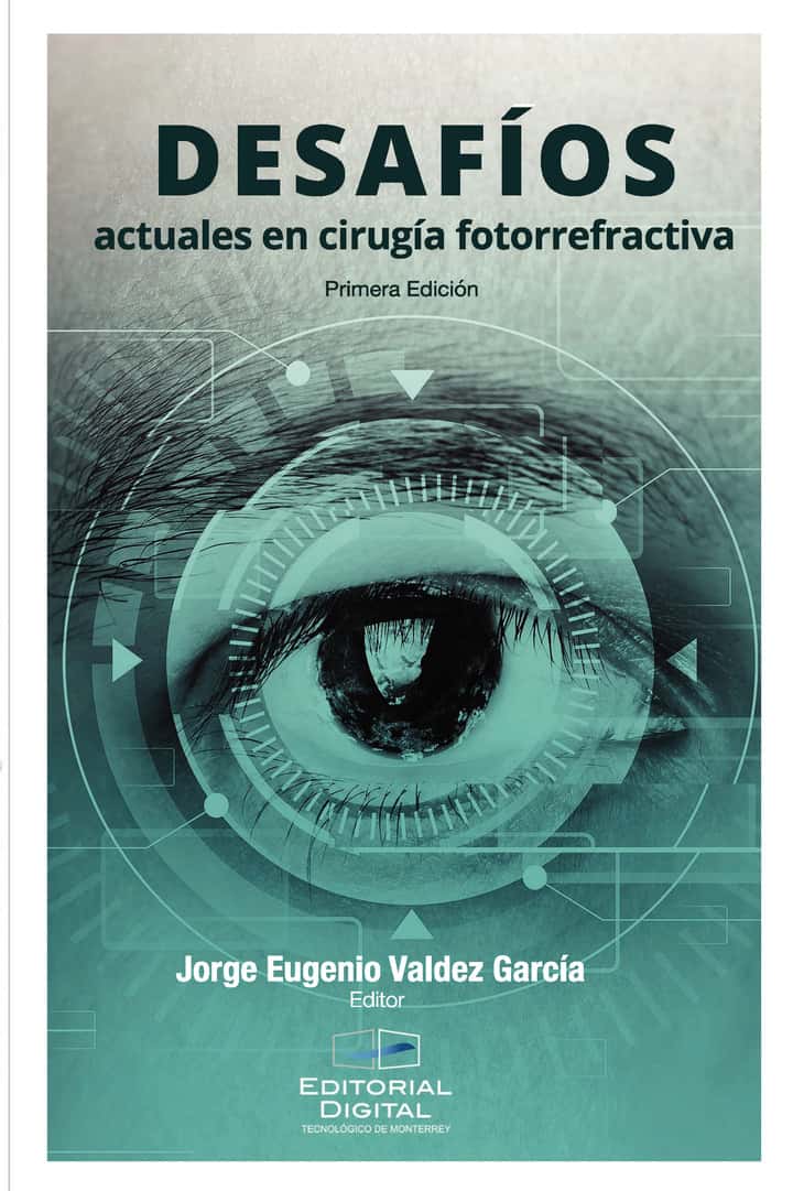 Desafíos actuales en cirugía fotorrefractiva