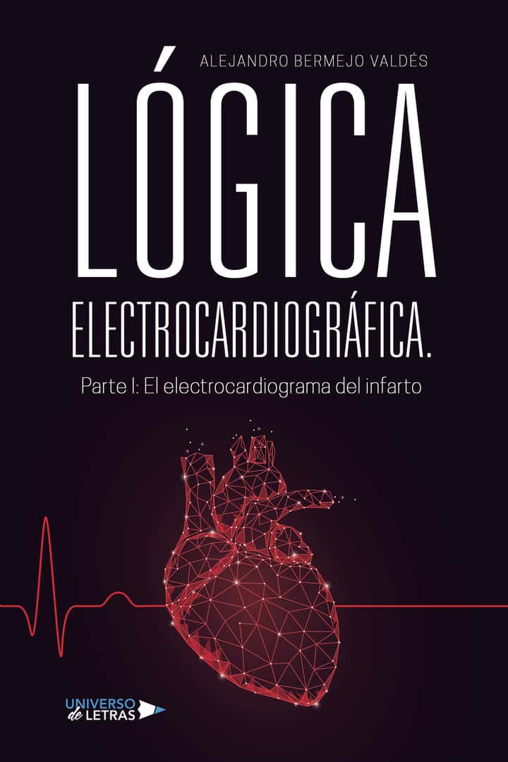 LÓGICA ELECTROCARDIOGRÁFICA. Parte I: El electrocardiograma del infarto