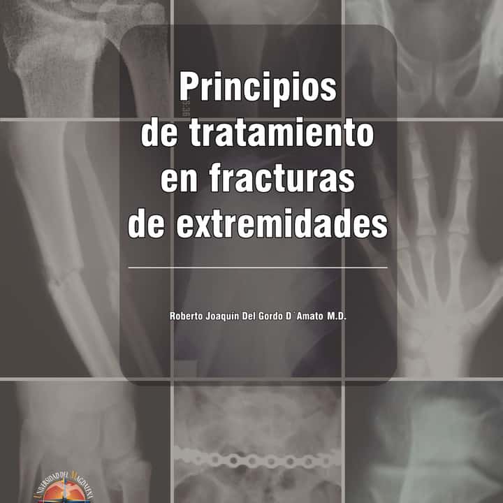 Principios de tratamiento en fracturas de extremidades