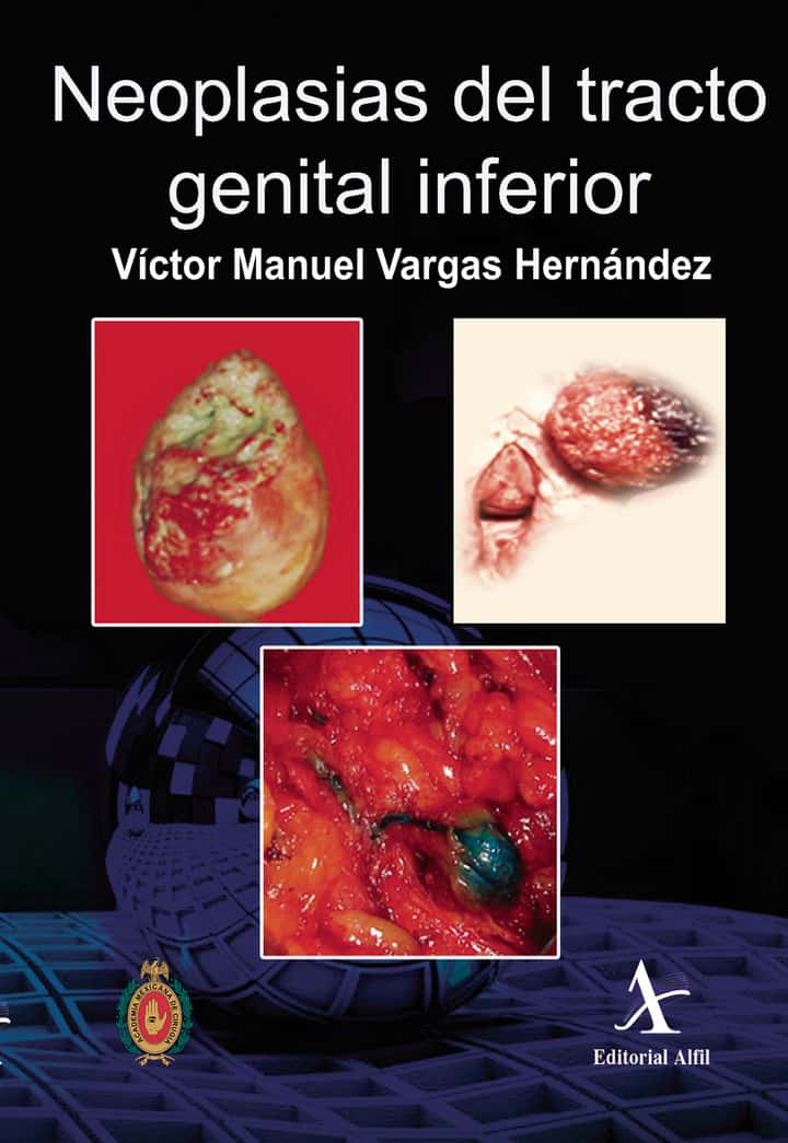 Neoplasias del tracto genital inferior