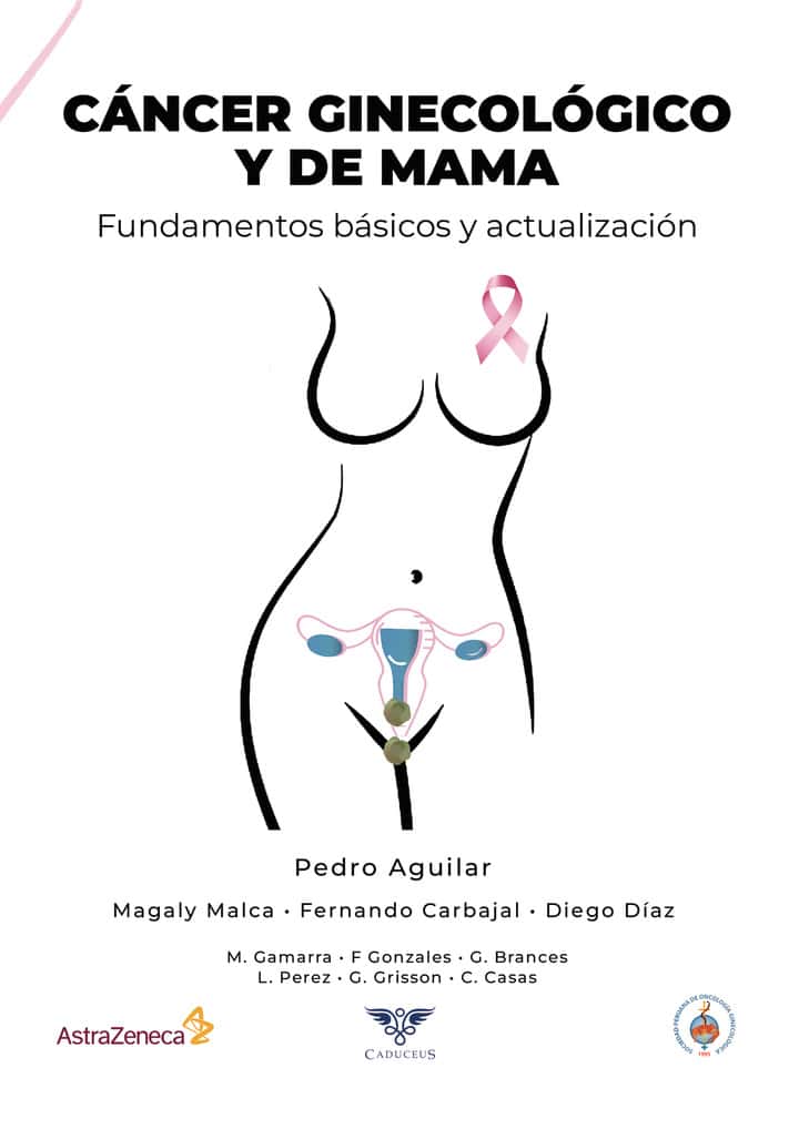Cáncer ginecológico y de mama: Fundamentos básicos y actualización
