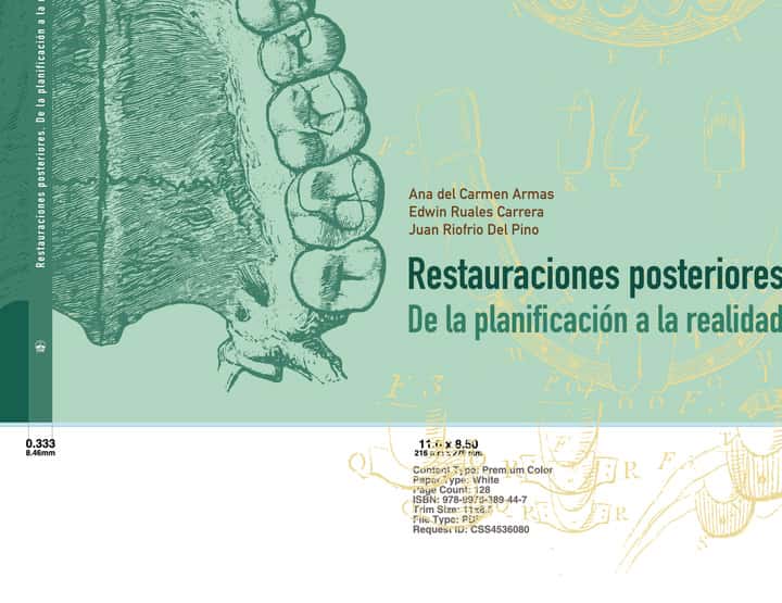 Restauraciones posteriores