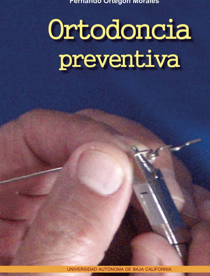 Ortodoncia preventiva