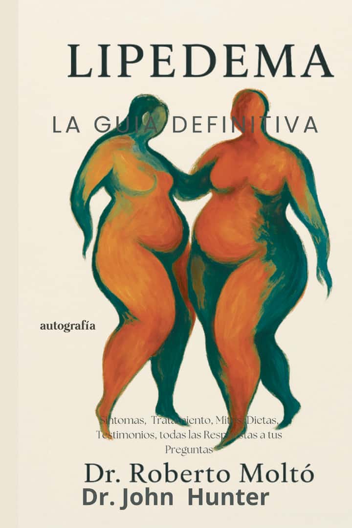 Lipedema: la guía definitiva