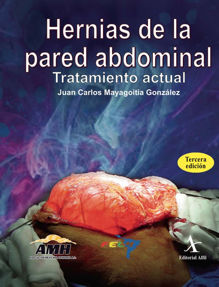 Hernias de la pared abdominal. Tratamiento actual. 3ra. Edición