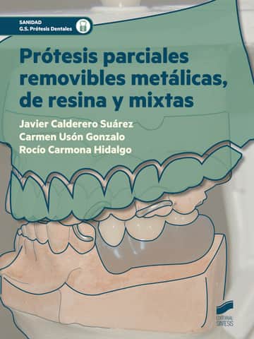 Prótesis parciales removibles metálicas, de resina y mixtas