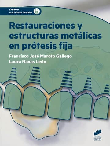 Restauraciones y estructuras metálicas en prótesis fija