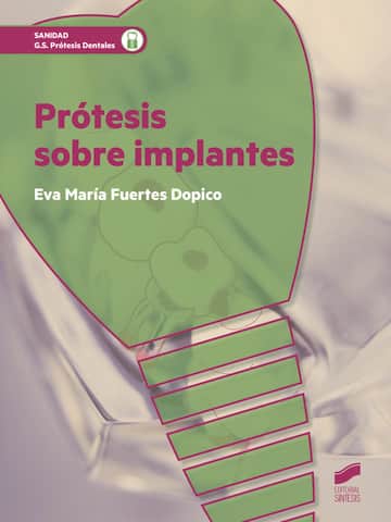 Prótesis sobre implantes