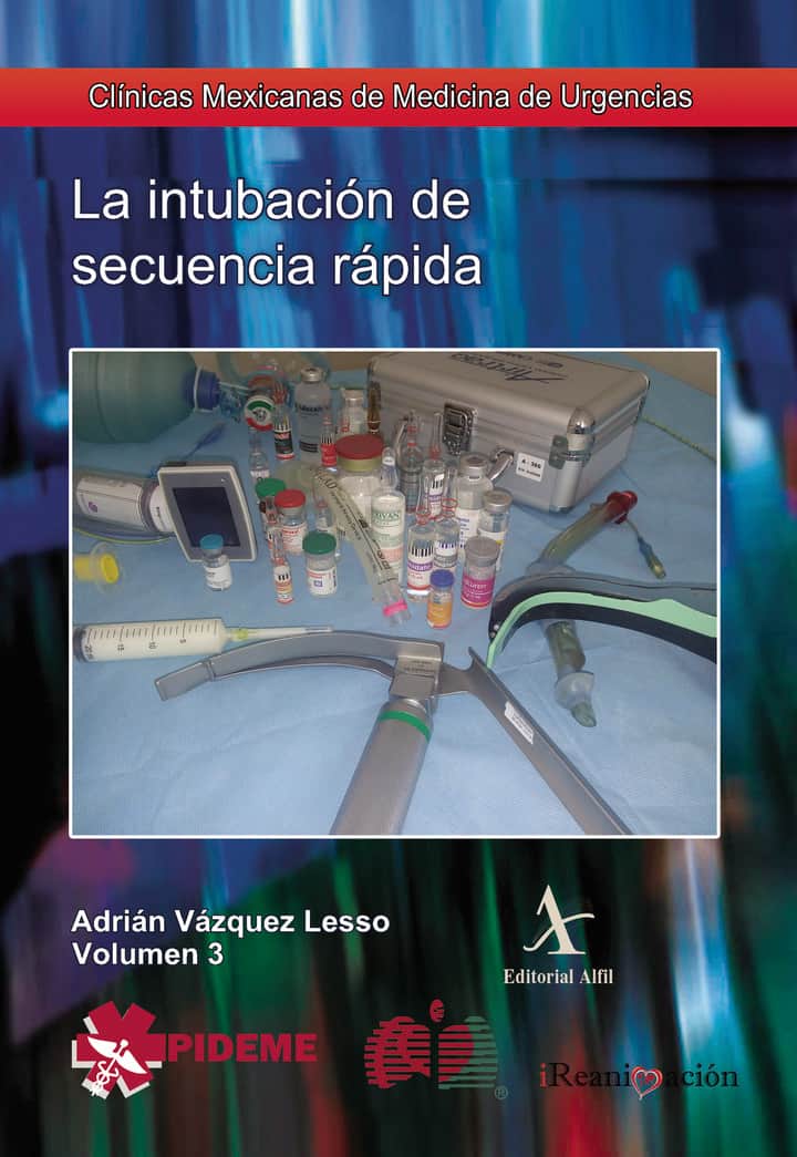 La intubación de secuencia rápida