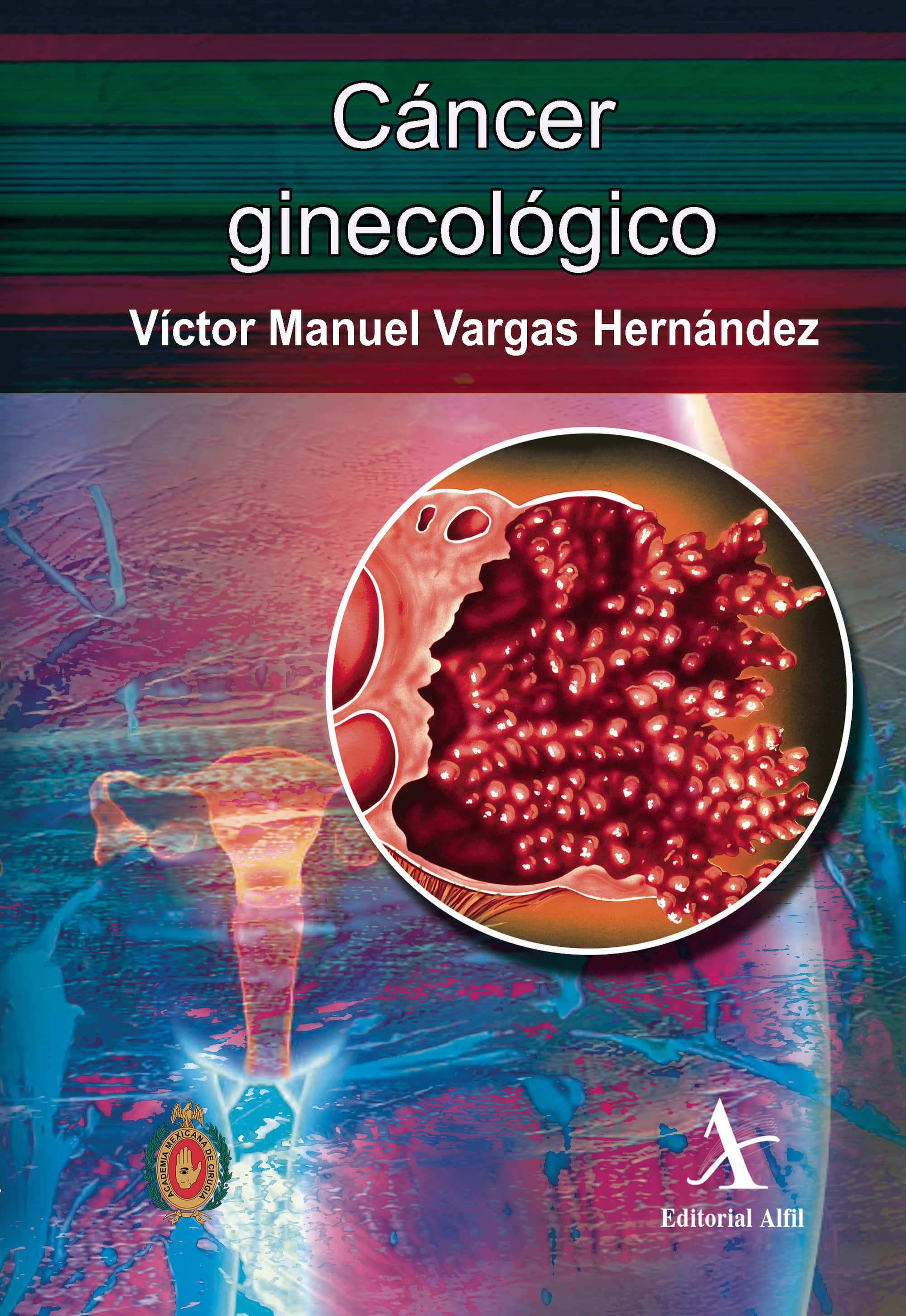 Cáncer ginecológico