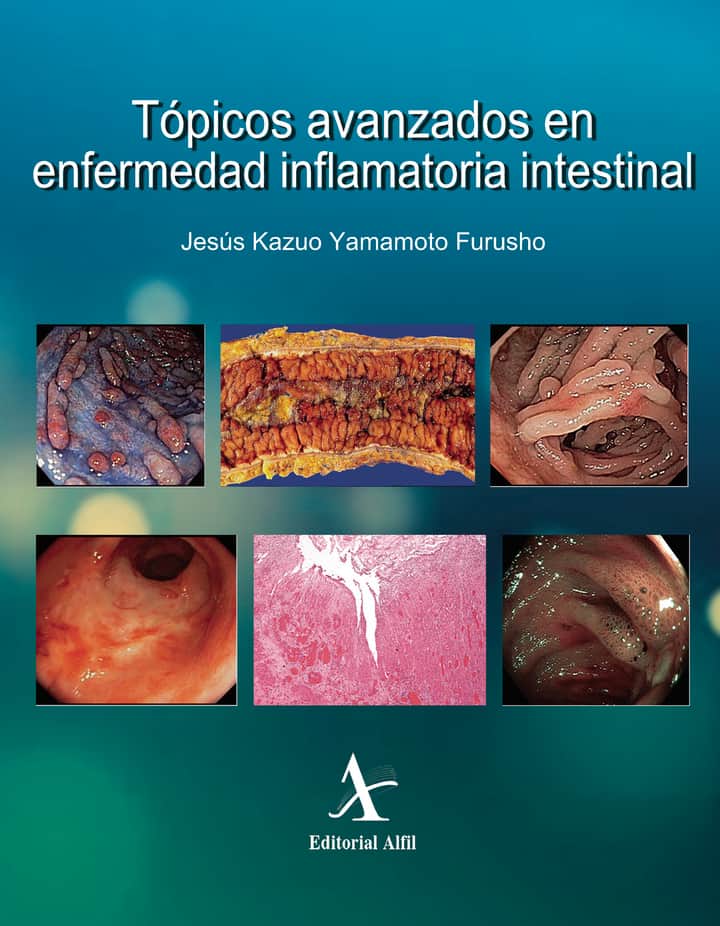 Tópicos avanzados en enfermedad inflamatoria intestinal