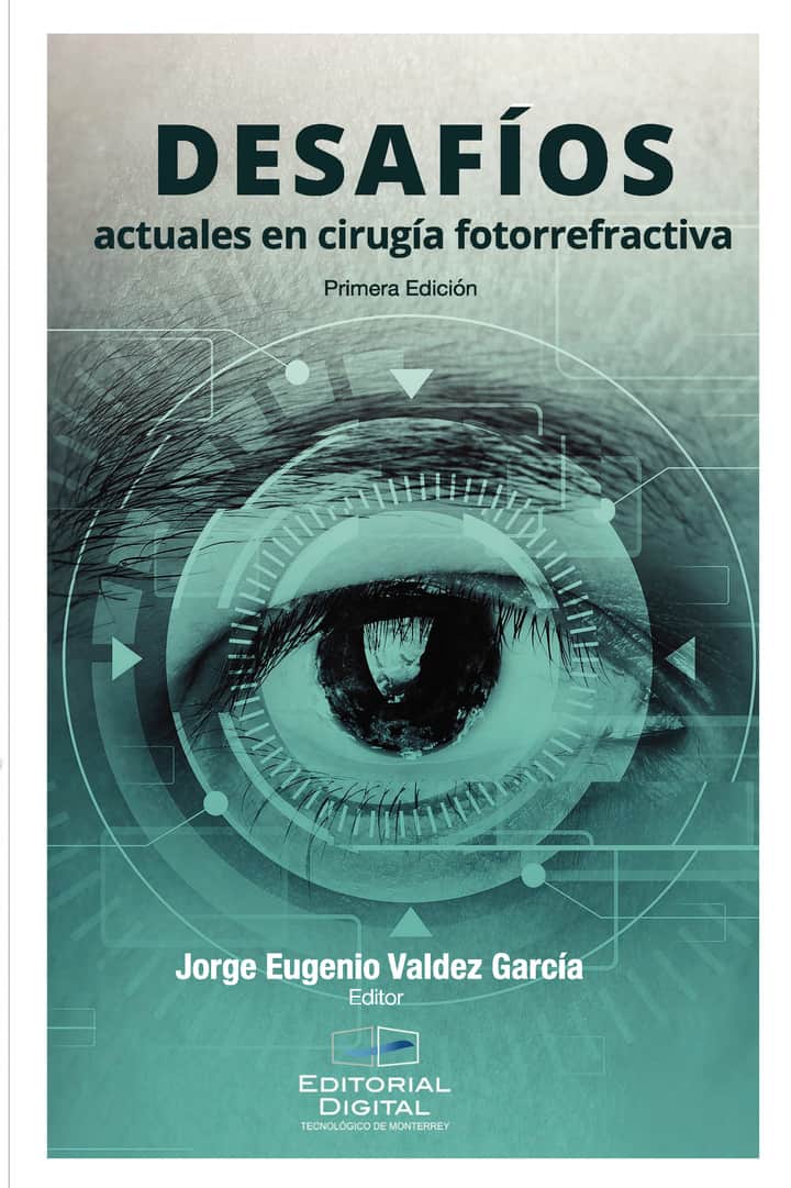 Desafíos actuales en cirugía fotorrefractiva