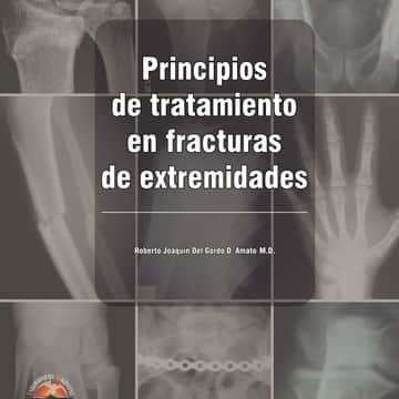 Principios de tratamiento en fracturas de extremidades