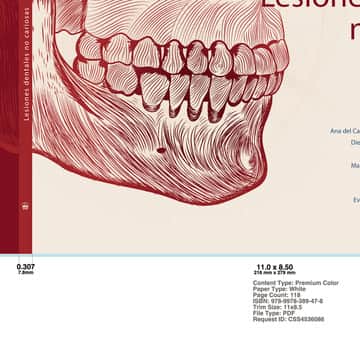 Lesiones dentales no cariosas