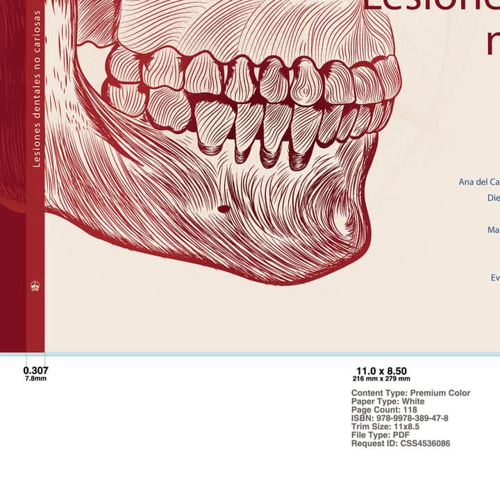Lesiones dentales no cariosas