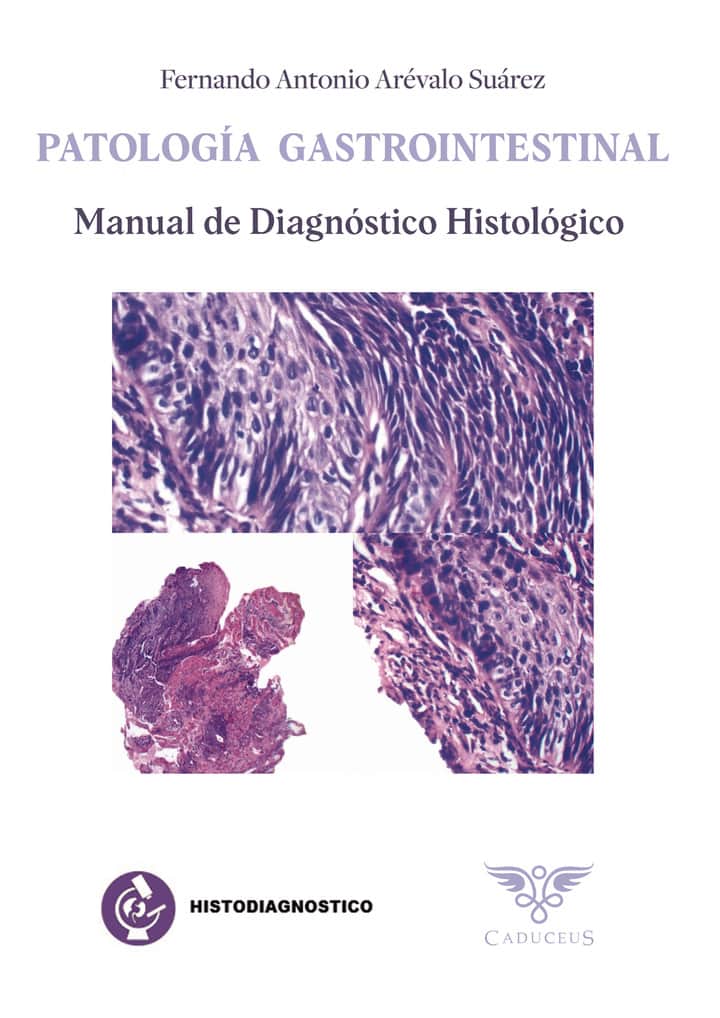 Histodiagnóstico. Patología gastrointestinal