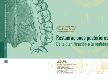 Restauraciones posteriores