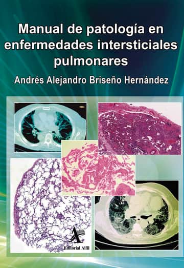 Manual de patología en enfermedades intersticiales pulmonares
