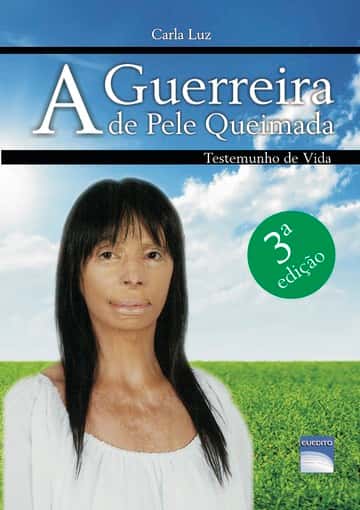 A Guerreira de Pele Queimada: Testemunho de Vida