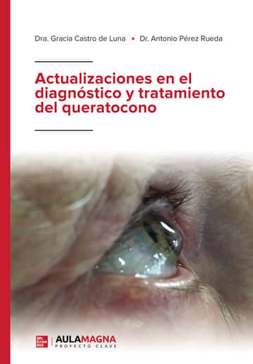 Actualizaciones en el diagnóstico y tratamiento del queratocono