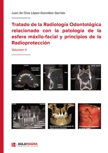 Tratado de la Radiología Odontológica relacionado con la patología de la esfera máxilo-facial y principios de la Radioprotección