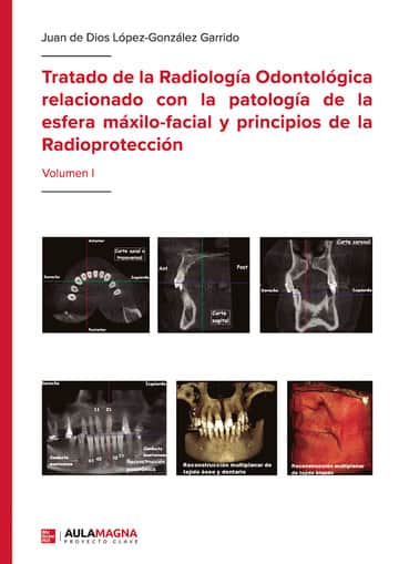 Tratado de la Radiología Odontológica relacionado con la patología de la esfera máxilo-facial y principios de la Radioprotección